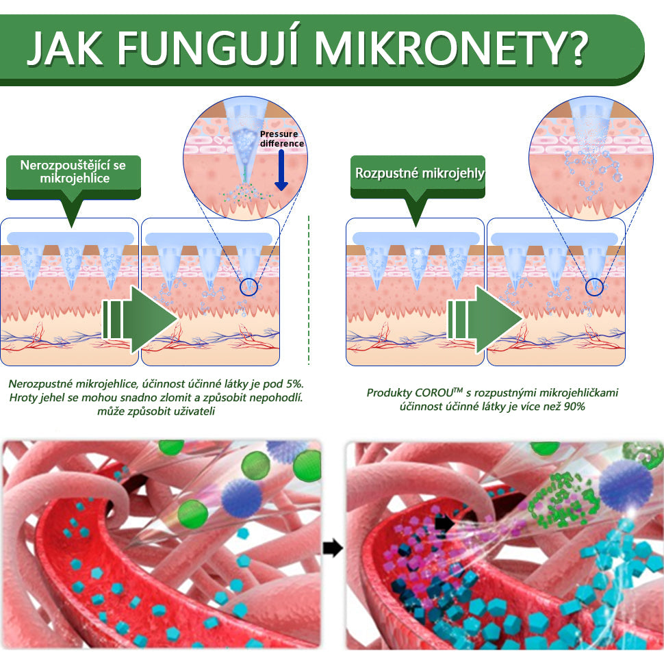 ⭐7denní výsledky⭐COROU™ SMGT-GLP-1 Nano Microneedle Patch(Bezbolestná, dlouhodobá, řešící diabetes, obezitu a kardiovaskulární onemocnění)