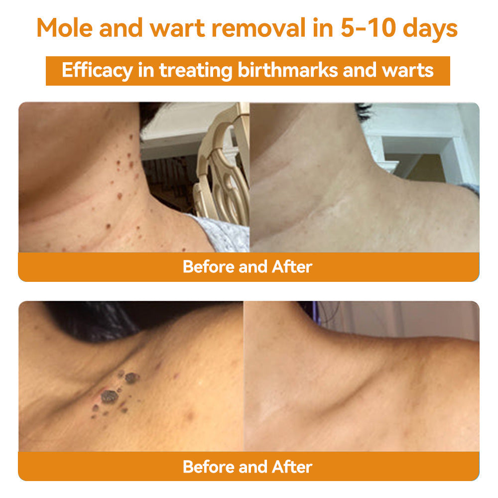 🏪𝑇𝑢𝑟𝑜𝑛𝑢™ Bee Venom Skin Treatment Cream(𝐴𝐴𝐷 𝑅𝑒𝑐𝑜𝑚𝑚𝑒𝑛𝑑𝑒𝑑)