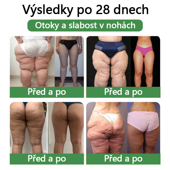 ⭐7denní výsledky⭐COROU™ SMGT-GLP-1 Nano Microneedle Patch(Bezbolestná, dlouhodobá, řešící diabetes, obezitu a kardiovaskulární onemocnění)