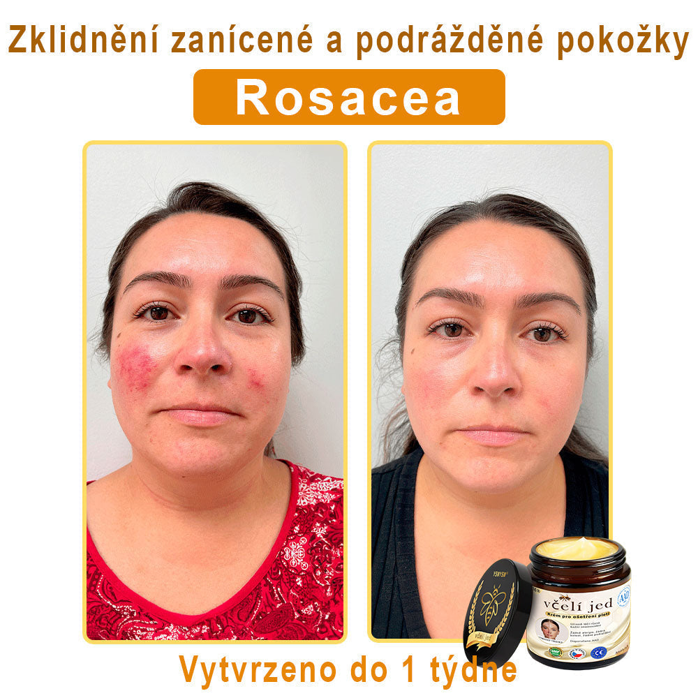 💥Doporučeno Univerzitní nemocnicí Motok | Oficiální obchod | YSMYSM® Krém na opravu pleti pro celé tělo: proti stárnutí, hydratace, oprava pleti, sjednocení tónu pleti, léčba akné a tmavých skvrn, odstraňování bradavic a znamének, úleva při psoriáze