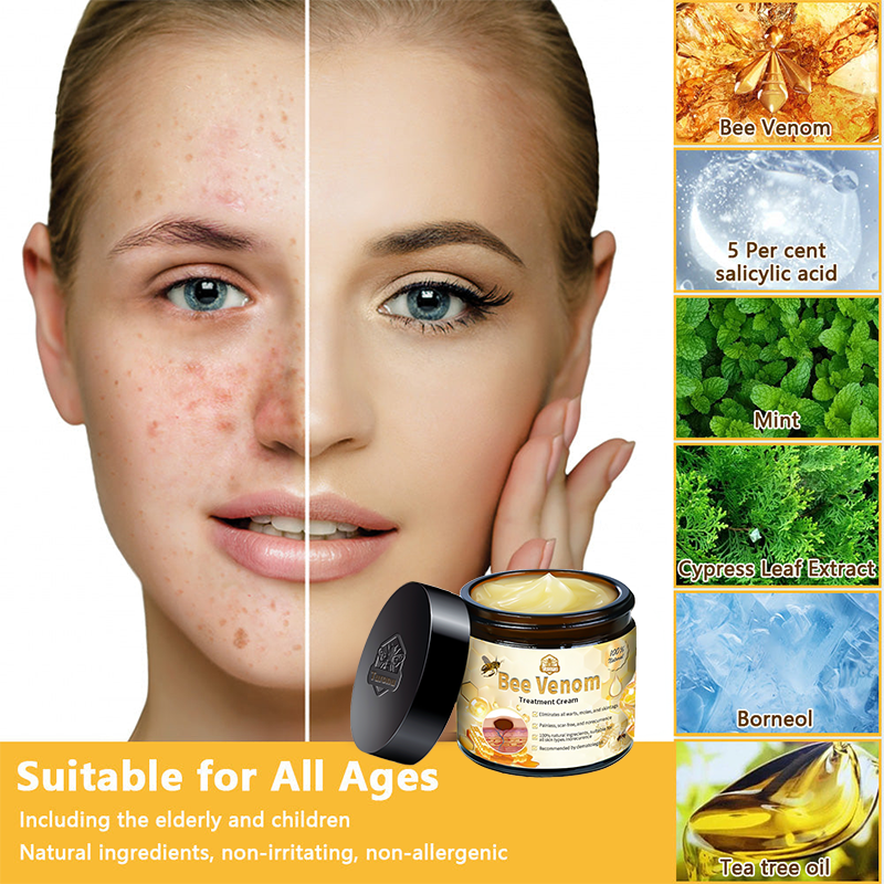 🏪𝑇𝑢𝑟𝑜𝑛𝑢™ Bee Venom Skin Treatment Cream(𝐴𝐴𝐷 𝑅𝑒𝑐𝑜𝑚𝑚𝑒𝑛𝑑𝑒𝑑)