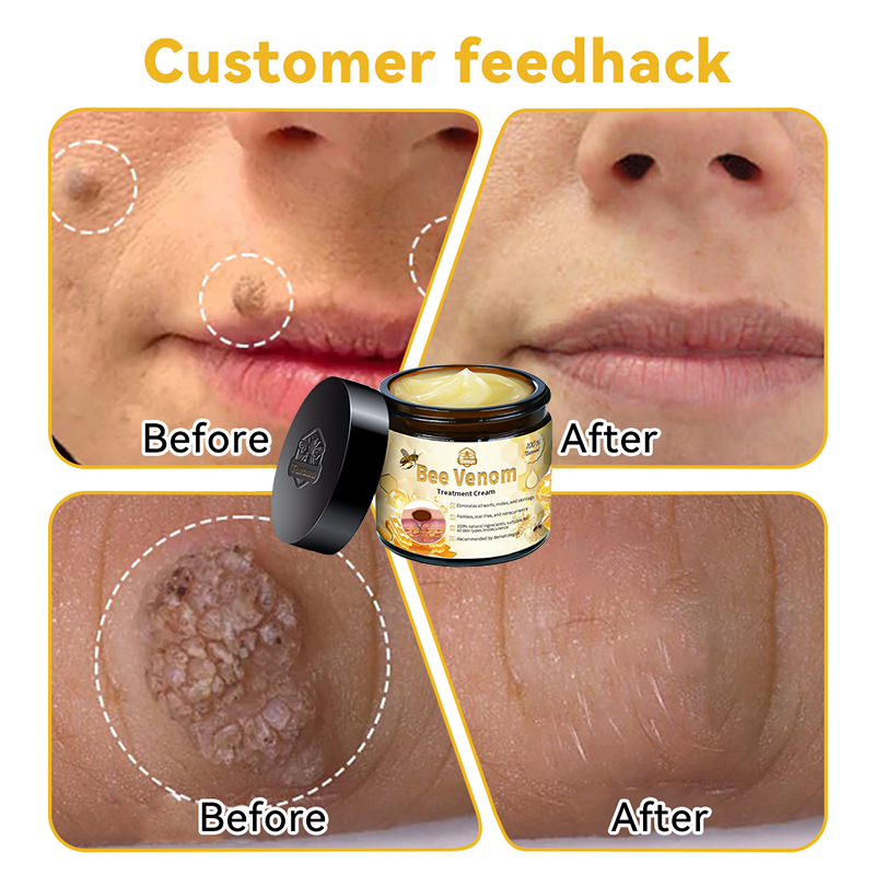 🏪𝑇𝑢𝑟𝑜𝑛𝑢™ Bee Venom Skin Treatment Cream(𝐴𝐴𝐷 𝑅𝑒𝑐𝑜𝑚𝑚𝑒𝑛𝑑𝑒𝑑)