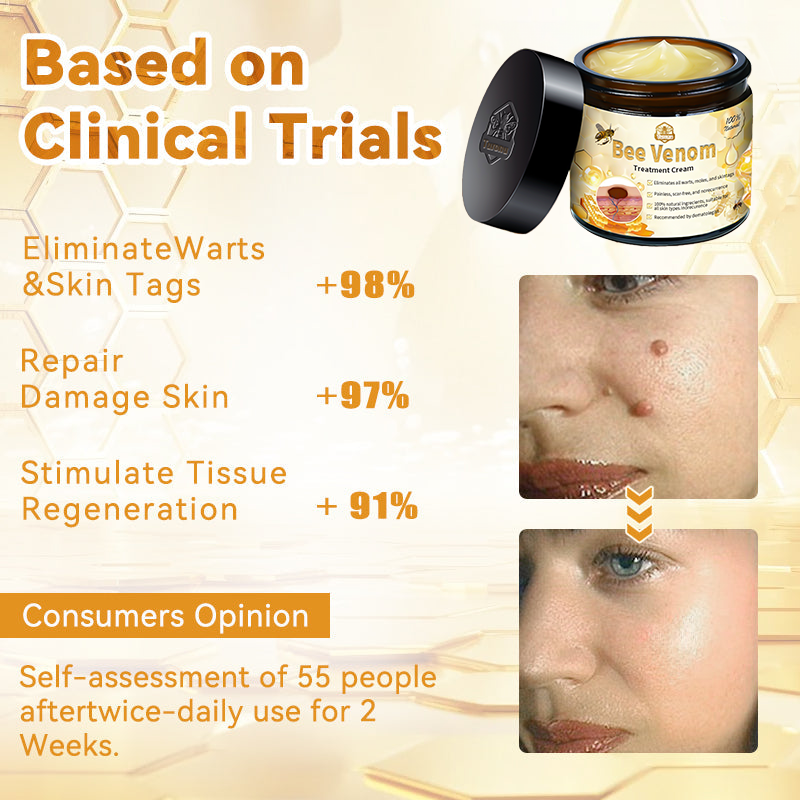 🏪𝑇𝑢𝑟𝑜𝑛𝑢™ Bee Venom Skin Treatment Cream(𝐴𝐴𝐷 𝑅𝑒𝑐𝑜𝑚𝑚𝑒𝑛𝑑𝑒𝑑)